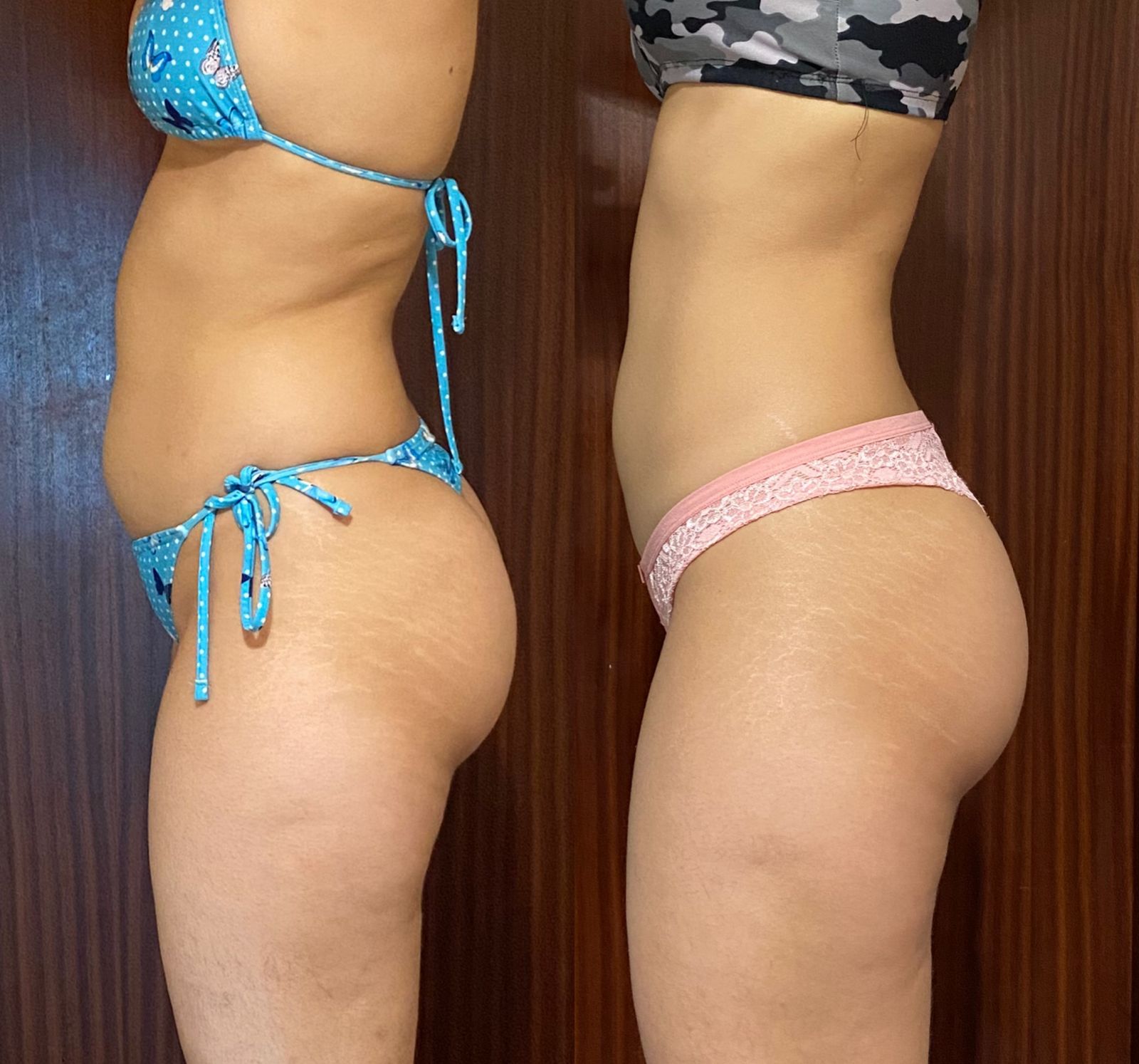 Resultado real 4 — comparativo antes e depois de um aluno acompanhado pela Consultoria HERO