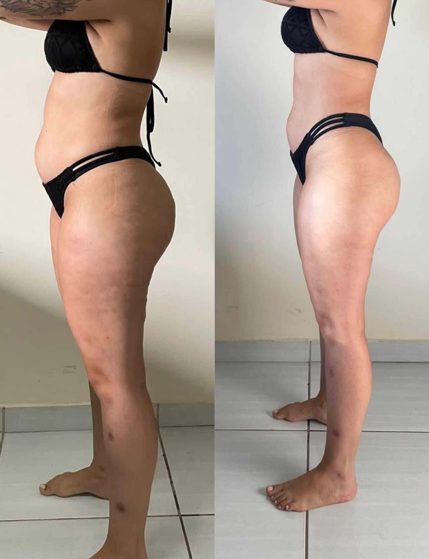 Resultado real 7 — comparativo antes e depois de um aluno acompanhado pela Consultoria HERO