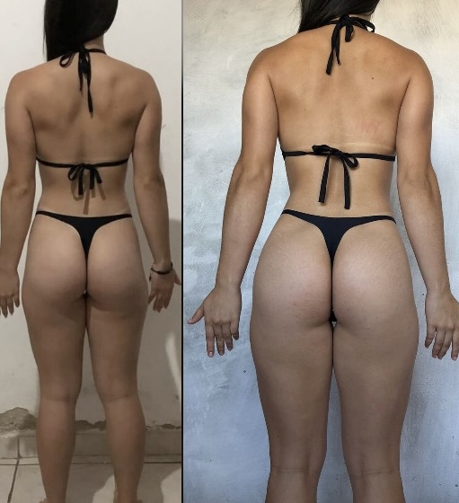 Resultado real 15 — comparativo antes e depois de um aluno acompanhado pela Consultoria HERO